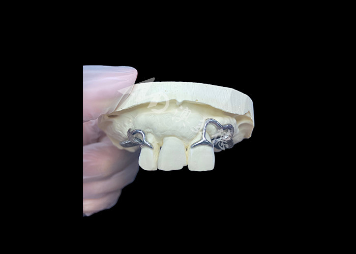 Easy Fit Custom Cast Parziale Protesi Stabile e naturale struttura per risultati rapidi
