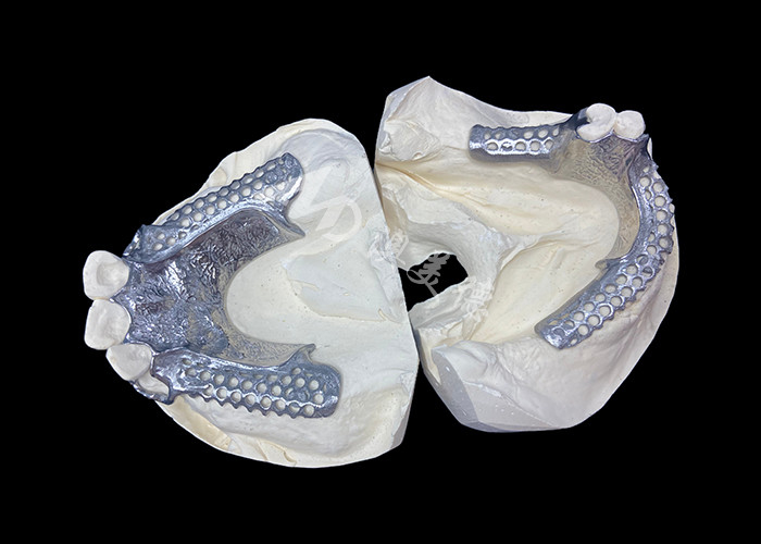 Easy Fit Custom Cast Parziale Protesi Stabile e naturale struttura per risultati rapidi