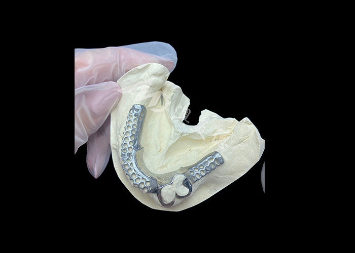 Easy Fit Custom Cast Parziale Protesi Stabile e naturale struttura per risultati rapidi