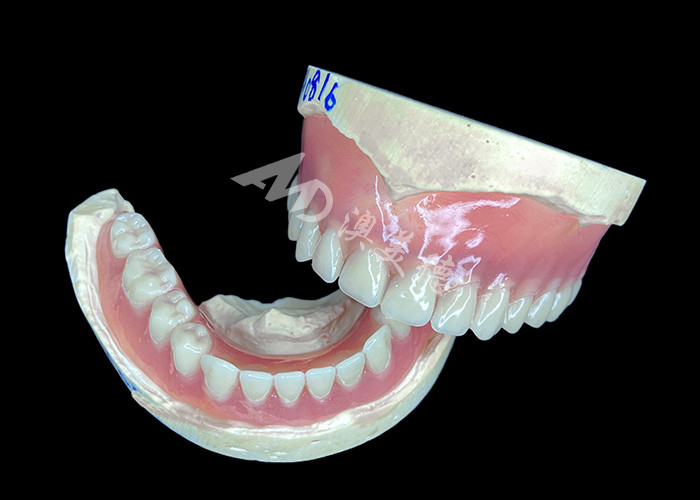 Denti parziali cast su misura, facili da pulire, ideali per ripristinare la capacità di masticare e il sorriso