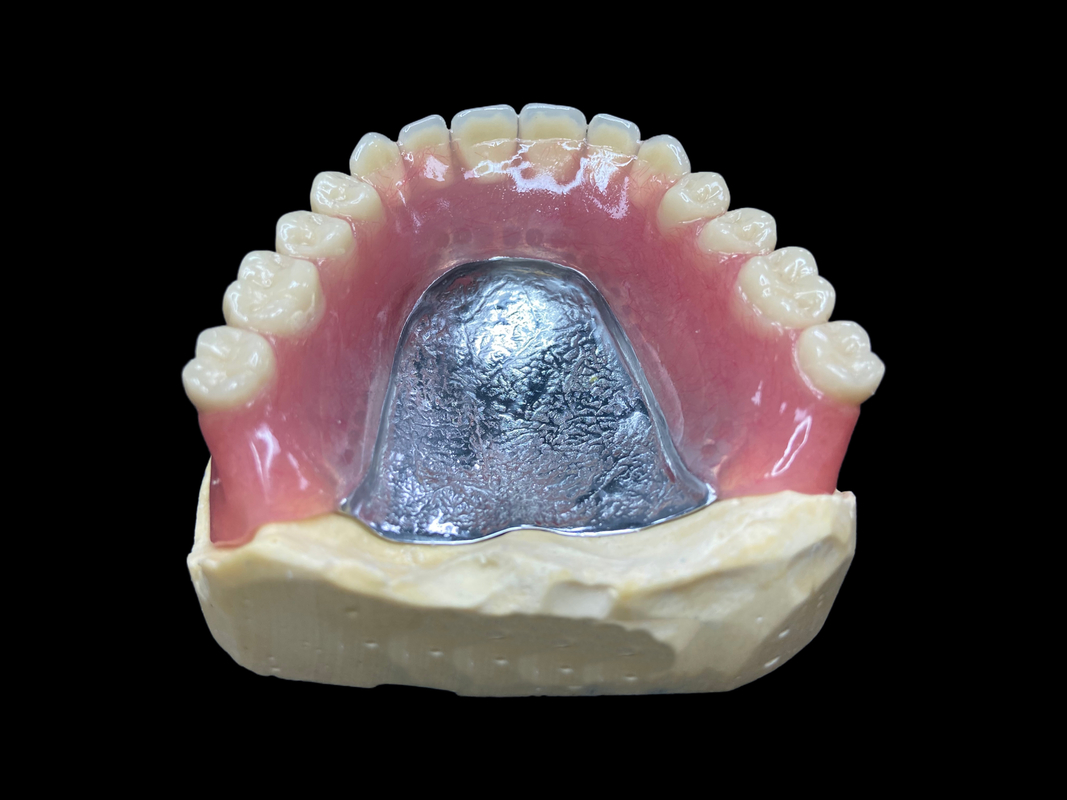 Denti parziali cast su misura, facili da pulire, ideali per ripristinare la capacità di masticare e il sorriso