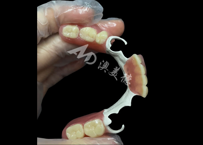 Dentiere parziali di casture durevoli su misura con telaio HPP per ripristinare il tuo sorriso