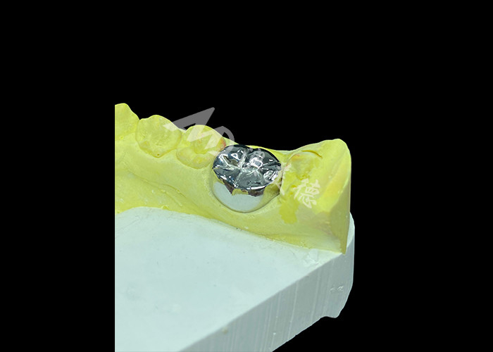 Funzione duratura Corona fusa in metallo durabile per la restaurazione dei denti superiore