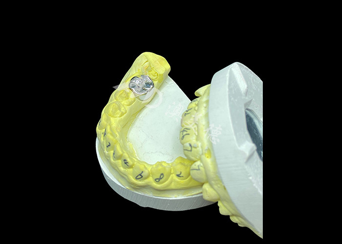 Funzione duratura Corona fusa in metallo durabile per la restaurazione dei denti superiore