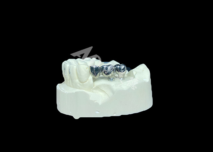 Impianto dentale a corona in titanio a lunga durata per sostituzione di denti mancanti