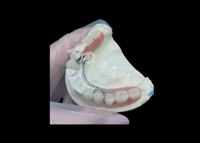 Porcellana resistente fusa al metallo corona dentale PFM corona per il restauro