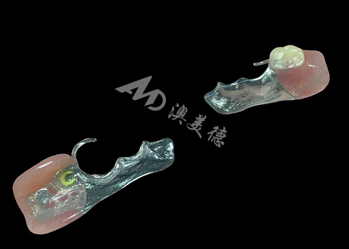 Denti parziali di precisione per l'adeguamento e la funzionalità ottimali