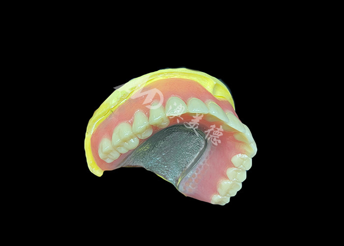 Denti parziali fuse progettate per la durata, il comfort e l'estetica e una durata maggiore