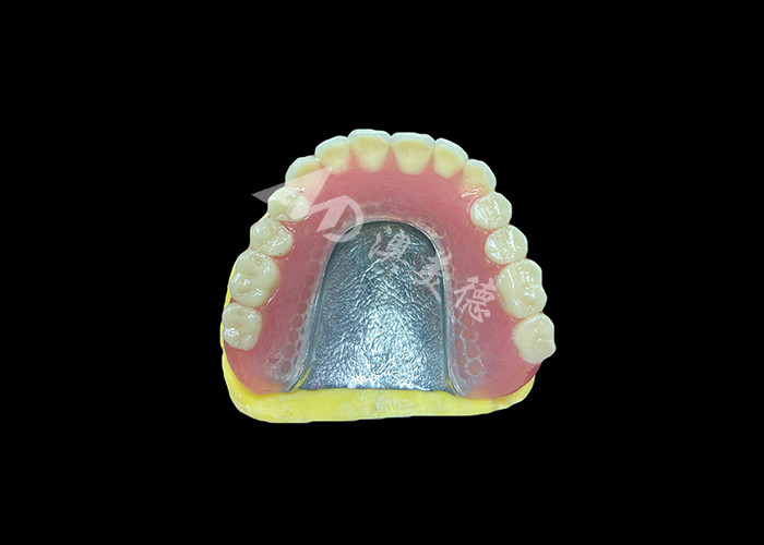 Denti parziali fuse progettate per la durata, il comfort e l'estetica e una durata maggiore