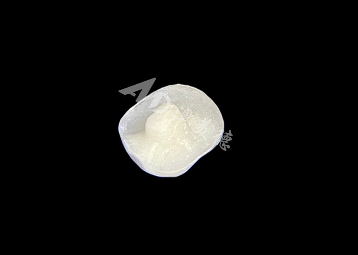 IPS E.max Infissi in ceramica Infissi in onlays Miscela senza saldature A aspetto naturale E resistente ai denti