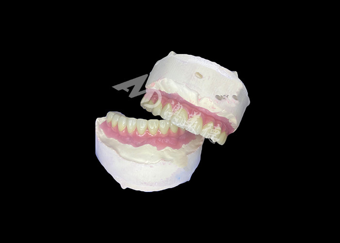 Dental All-on-6 Dental Implant Supported Dentures con stabilità e comfort