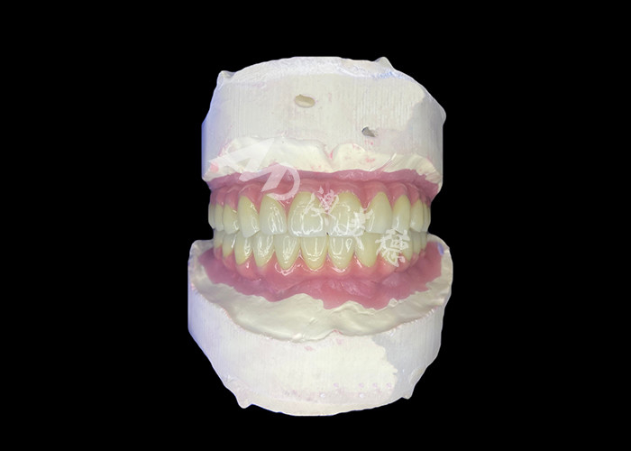 Dental All-on-6 Dental Implant Supported Dentures con stabilità e comfort