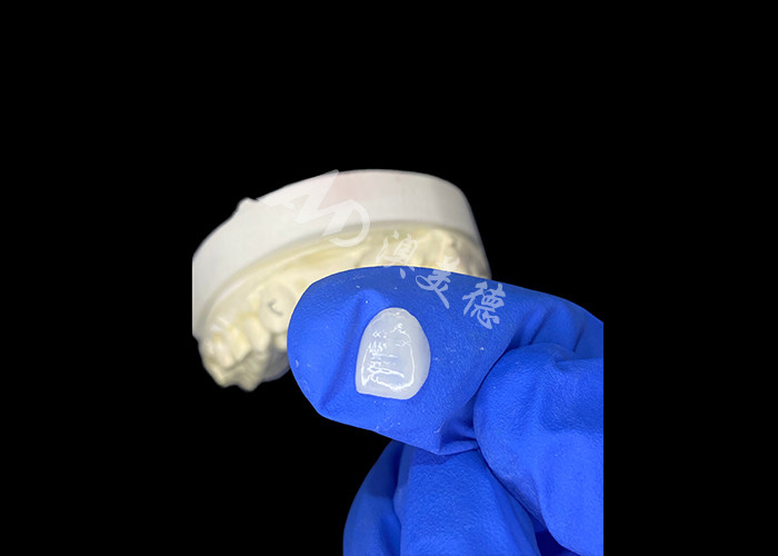 IPS e.max Finiture per incisivi in tonalità A1 Estetica naturale per sorrisi impeccabili