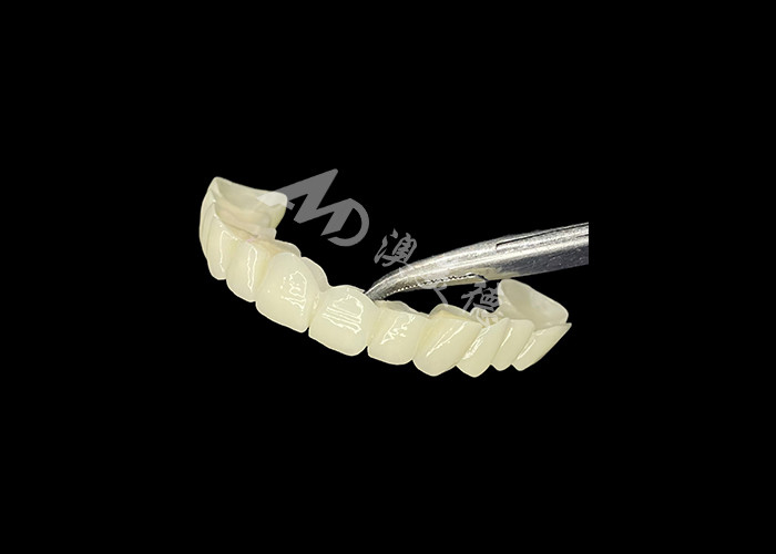 Ponte dentale in zirconia ad alta traslucidità Forte e naturale per il ripristino del sorriso senza soluzione di continuità