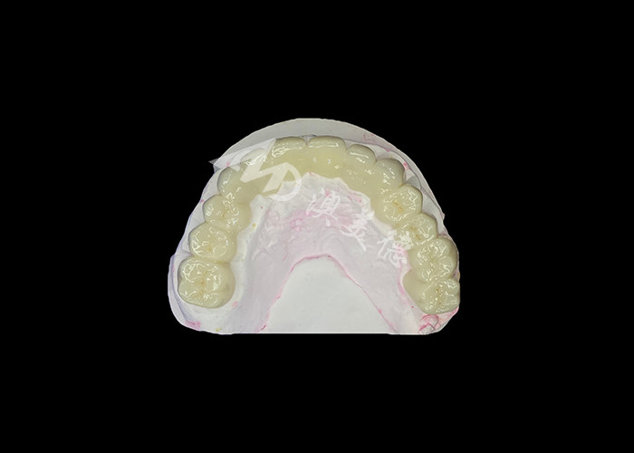 Ponte dentale in zirconia ad alta traslucidità Forte e naturale per il ripristino del sorriso senza soluzione di continuità