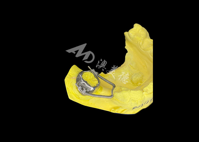 Recuperatore a loop scorrevole per un recupero di spazio efficace e un movimento dentale preciso per ottenere un allineamento ottimale nei trattamenti ortodontici