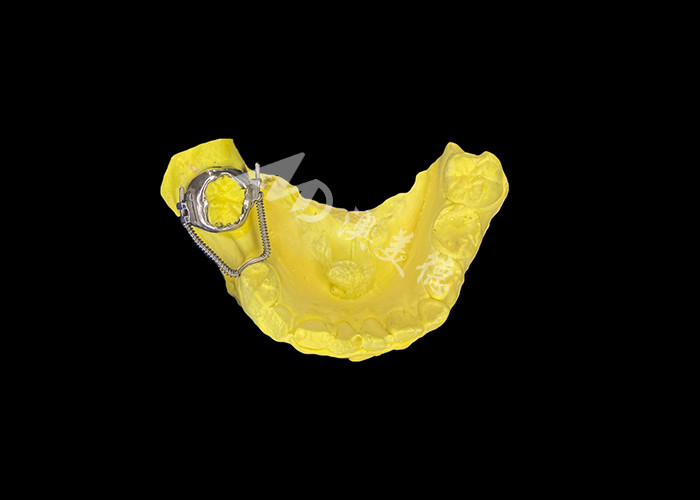 Recuperatore a loop scorrevole per un recupero di spazio efficace e un movimento dentale preciso per ottenere un allineamento ottimale nei trattamenti ortodontici