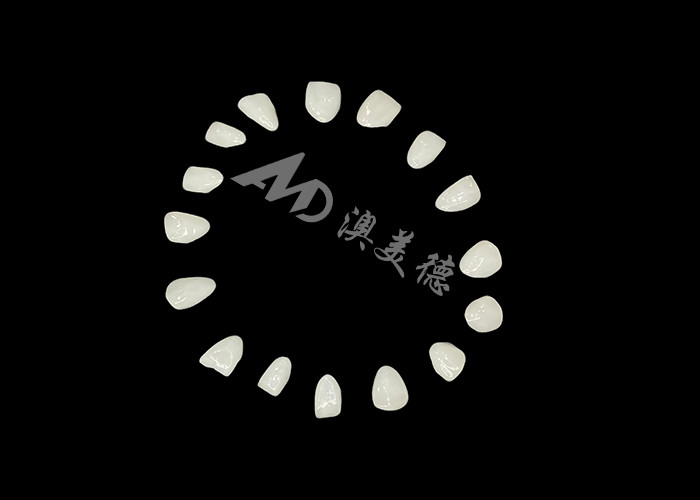 Veneers IPS e.max di precisione per trasformazioni senza rivali del sorriso che offrono un'estetica di durata eccezionale