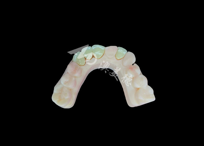 Naturale e confortevole Corrispondenza Circonia corona di porcellana Cina laboratorio dentale ombra personalizzabile
