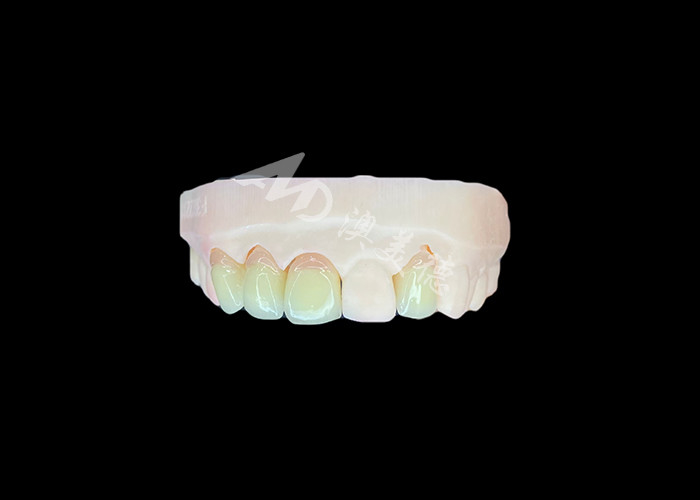 Naturale e confortevole Corrispondenza Circonia corona di porcellana Cina laboratorio dentale ombra personalizzabile