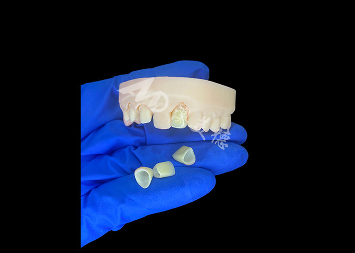Naturale e confortevole Corrispondenza Circonia corona di porcellana Cina laboratorio dentale ombra personalizzabile