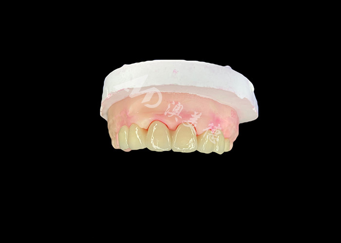 Wieland Zenostar Ceramic Crown Bridge Alta precisione per restauri durevoli e naturali