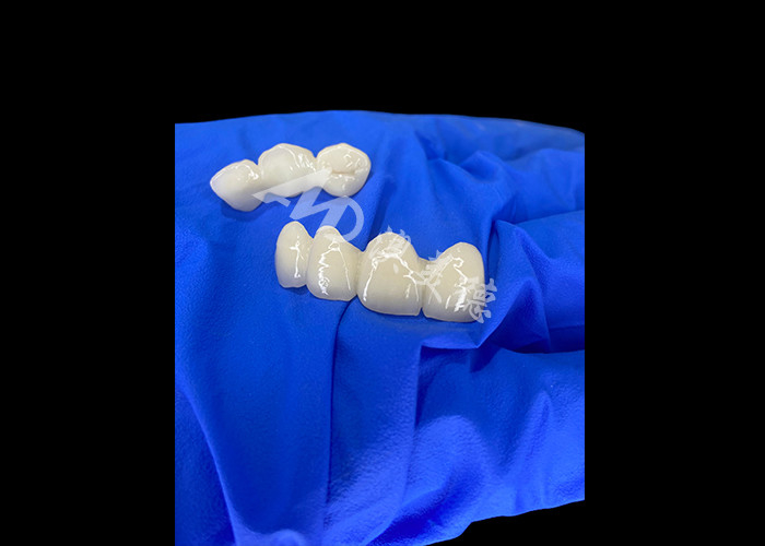 Wieland Zenostar Ceramic Crown Bridge Alta precisione per restauri durevoli e naturali