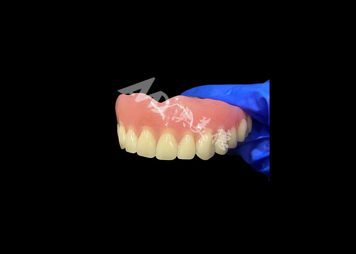Dentiera acrilica a arco completo Una soluzione conveniente per le esigenze internazionali di dentiere rimovibili
