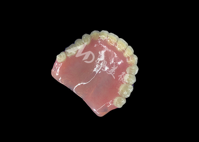 Dentiera acrilica a arco completo Una soluzione conveniente per le esigenze internazionali di dentiere rimovibili