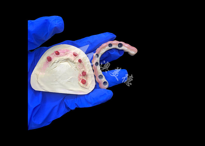 Abutment in titanio ed impianto di corona in zirconia Protesi protesi supportate Precisione adatta per indossare comodamente