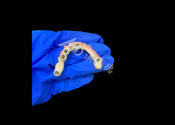 Abutment in titanio ed impianto di corona in zirconia Protesi protesi supportate Precisione adatta per indossare comodamente