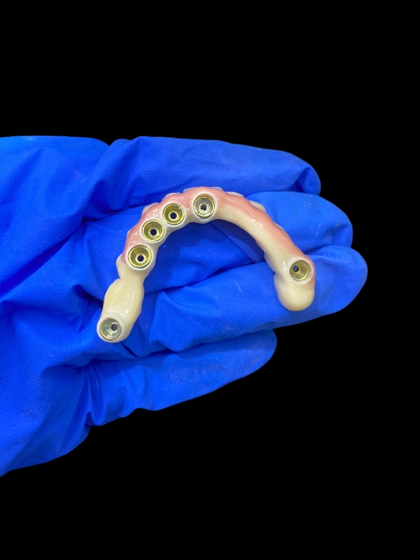 Abutment in titanio ed impianto di corona in zirconia Protesi protesi supportate Precisione adatta per indossare comodamente