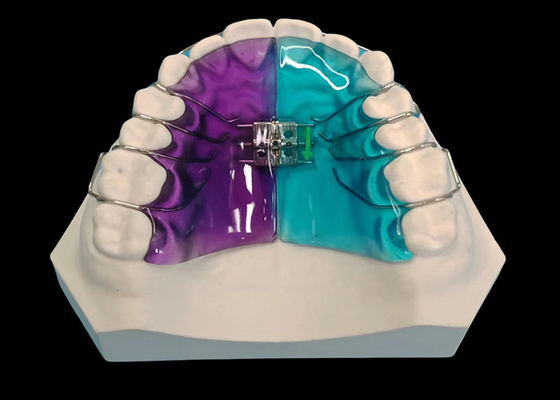 Buon prezzo Espansivo rimovibile per un trattamento ortodontico efficace e per migliorare il sorriso in linea