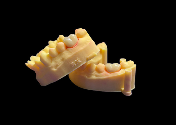 Buon prezzo Corona dentale in porcellana di zirconia di alta qualità Forza ineguagliabile Precisione adatta e estetica e durata eccezionali in linea