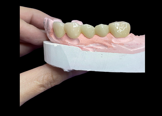 Buon prezzo Tutte le corone e i ponti in ceramica progettati per un'estetica superiore, durabilità e adattamento naturale per una fiducia duratura in linea