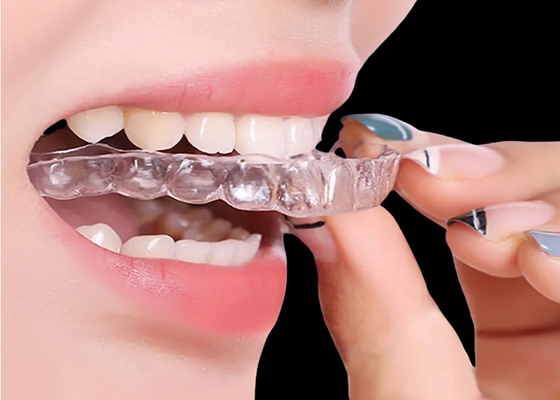 Buon prezzo Apparecchi ortodontici per un trattamento rapido ed efficace in linea