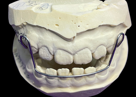 Buon prezzo Guida Arco Apparecchio Ortodontici Ritenitori Allineatori Con Buona Ritenzione Provata Comodità in linea