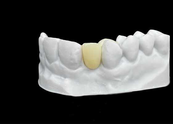 Buon prezzo Resistenza ai frantumi Corona dentale in zirconia con eccezionale resistenza e traslucidità in linea