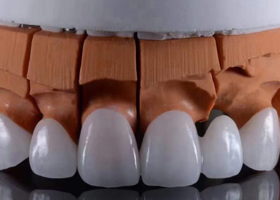 Buon prezzo Corone dentali in zirconia traslucide approvate dalla FDA, perfette con aspetto estetico naturale in linea