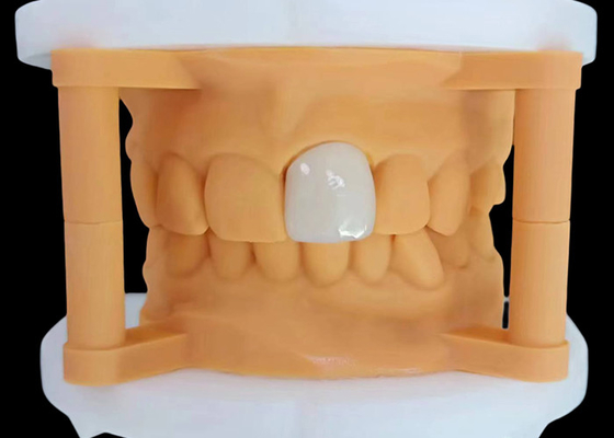 Buon prezzo Corona dentale a zirconia traslucida con prestazioni estetiche dal laboratorio dentale cinese in linea