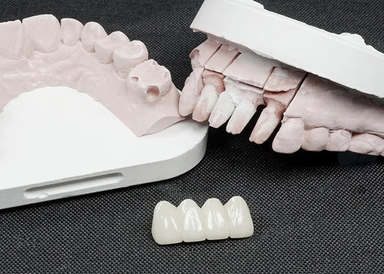 Buon prezzo Coroane dentali in zirconia di alta qualità per una resistenza superiore ed estetica naturale in linea