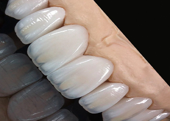 Buon prezzo Traslucidità Ponte corona in ceramica resistente alle macchie Adatta perfettamente per un sorriso naturale in linea