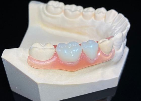 Buon prezzo OEM Protesi dentali rimovibili invisibili Protesi dentali parziali in resina acrilica su misura in linea