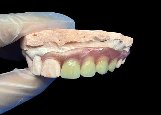 Buon prezzo Protesi parziali invisibili flessibili per una forma comoda, sicura e naturale in linea