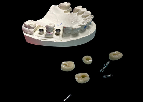 Buon prezzo Impianto dentale a vite di superficie lucidata corona mantenuta per la sostituzione dei denti in linea
