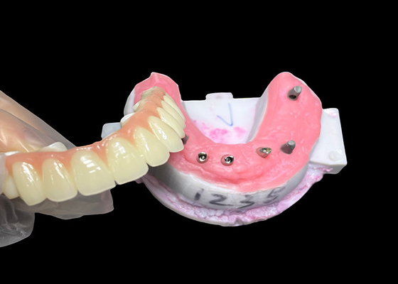 Buon prezzo Impianto supportato Protesi a arco completo Impianto dentale fisso Ponte corona ceramica in linea