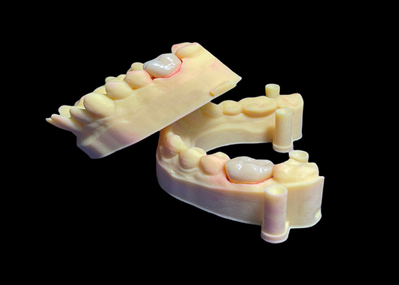 Buon prezzo Corona di zirconia dentale biocompatibile per denti singoli / multipli ad alta resistenza in linea