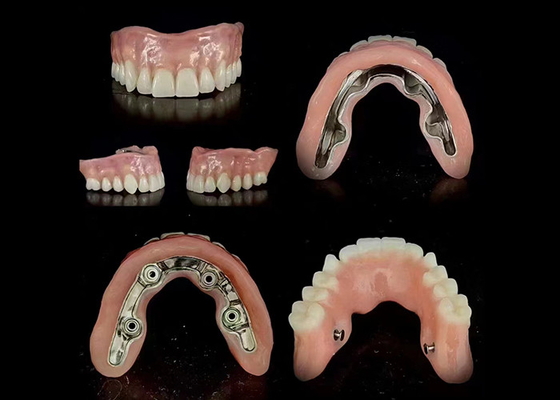 Buon prezzo Implantazione di barre precise protesi ibrida supportata adattamento sicuro stabilità regolabile in linea