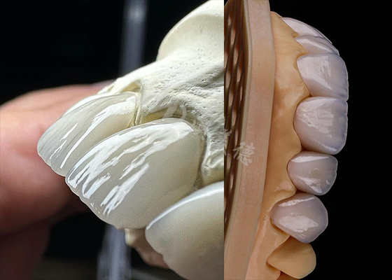 Buon prezzo Dental durable, corona di zirconia solida, denti coronati in perfetta forma, laboratorio dentale di zirconia. in linea