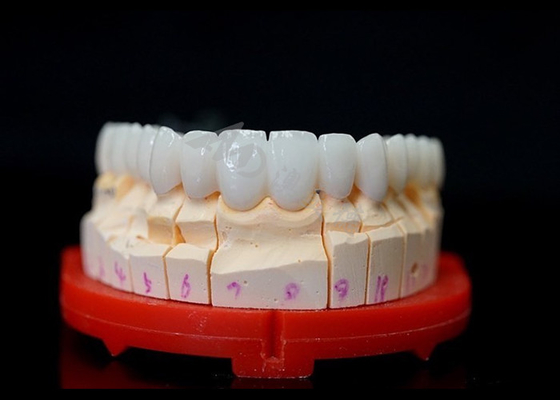 Buon prezzo Corone di zirconia perfettamente adattate, corone di zirconia altamente biocompatibili per denti. in linea
